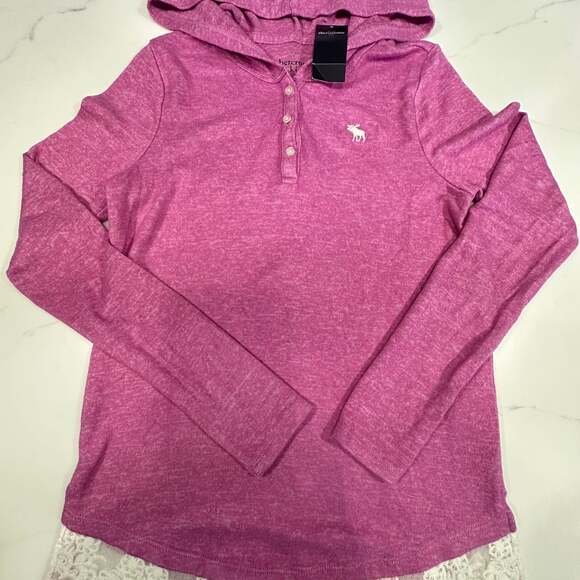 Abercrombie Kids Other - NWT! Abercrombie Kids Girls’ Pink Henley Long Sleeve Shirt with Lace Trim 11/12